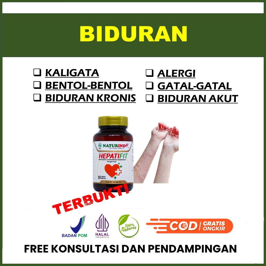 Biduran Kaligata Alergi Gatal Gatal Biduran Akut Kronis Menahun Hepatifit Naturindo BPOM