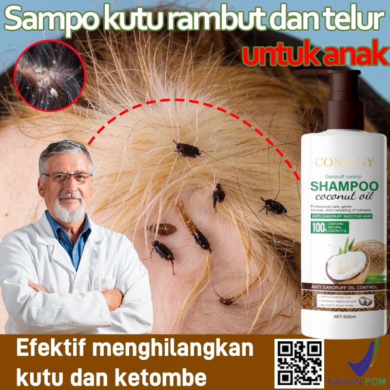 Shampoo Kutu Rambut Anak Dan Dewasa Coconut Shampoo Anti Ketombe Dan Gatal Sampo Penghilang Kutu Ant