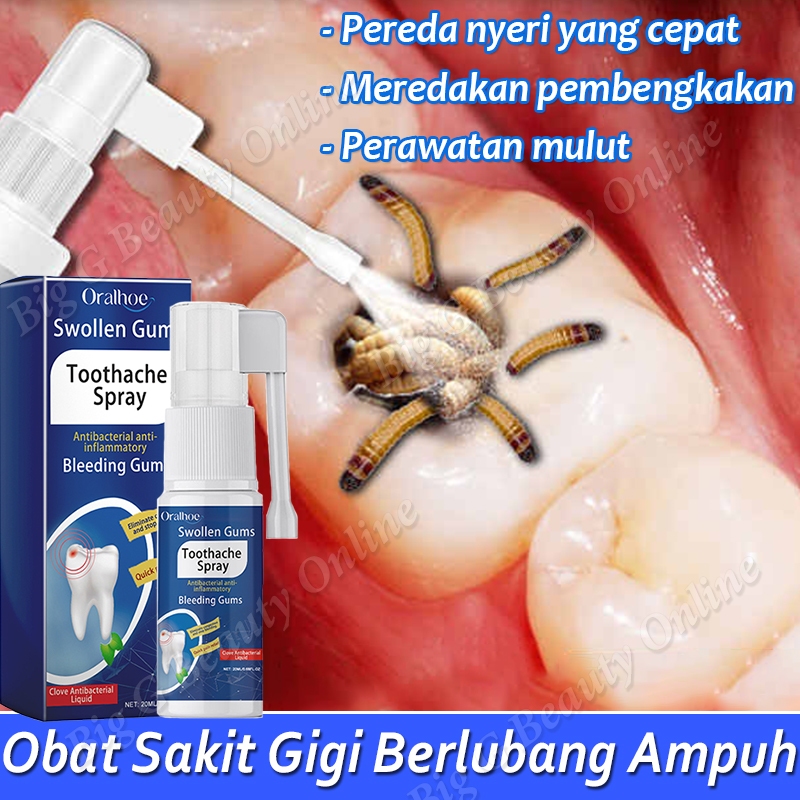 Obat Sakit Gigi Semprot Obat Sakit Gigi Berlubang Oral Perawatan Gigi Semprotan Pereda Nyeri Sakit G