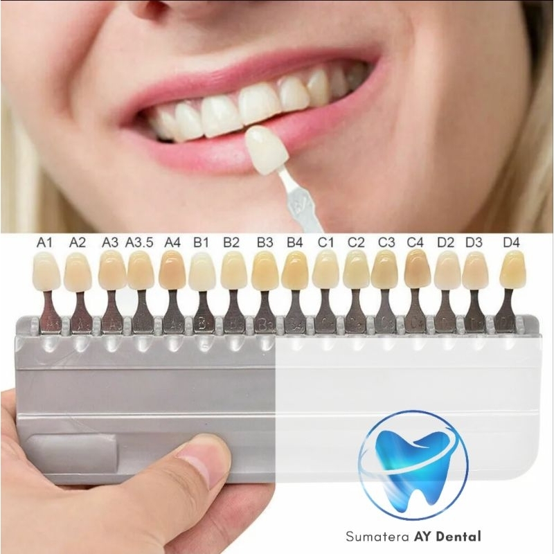 Dental Shade Guide Vita Contoh Warna Gigi Tiruan