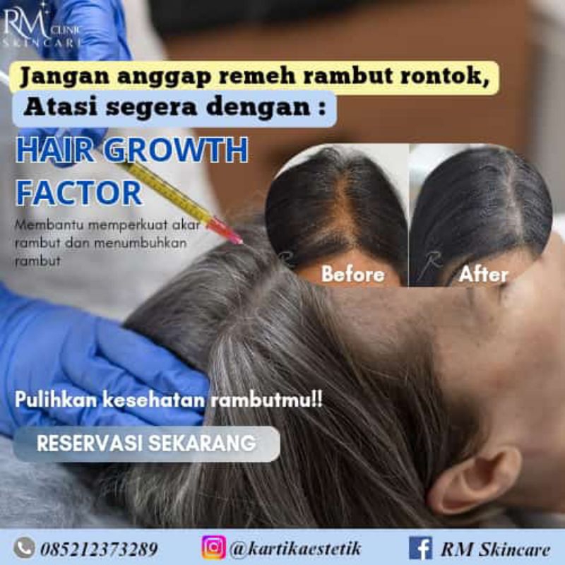 RM CLINIC VOUCHER HAIR GROWTH FACTOR