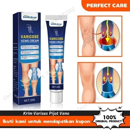 South Moon Varicose Veins Cream 20gr Obat Varises Salep Obat Varises Kaki Menghilangkan Varises Di K