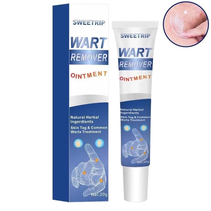 Menghilangkan Kutil Tahi Lalat Penghilang Tahi Lalat Penghilang Kutil Dan Tahi Lalat