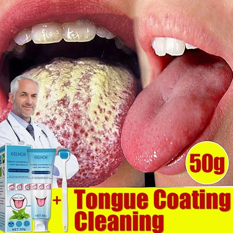 Gel Pembersih Lidah Melawan Nafas Bau Dan Panas Dalam Tongue Cleaner Alat & Anak Pembersih Lidah Dew