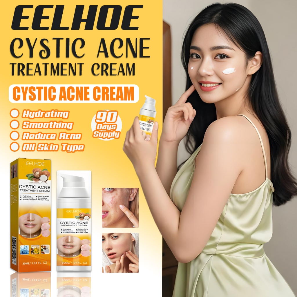 EELHOE obat cina jerawat ampuh /obat jerawat cina paling ampuh 30ML /ANTI-ACNE Skin CREAM / Salep Kr