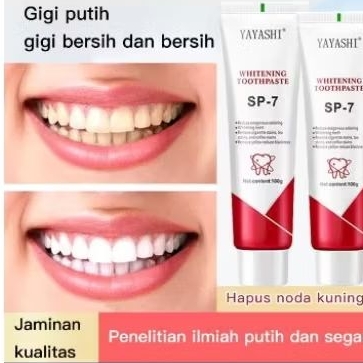 Pasta Gigi SP-7 Fresh Bright Pemutih Gigi dan Perontok Karang Gigi