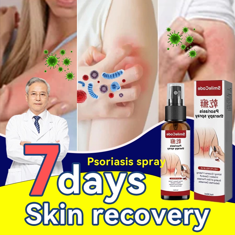 Salep gatal paling ampuh Obat psoriasis obat gatal salep kutil Obat Gatal Salep gatal Salep psoriasi