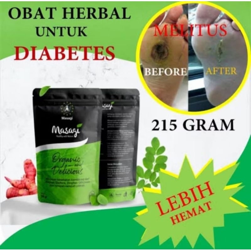Masagi Obat Diabetes Perbaikan Pankreas Gula Darah Stabil & Normal Herbal - Masagi 215 gram