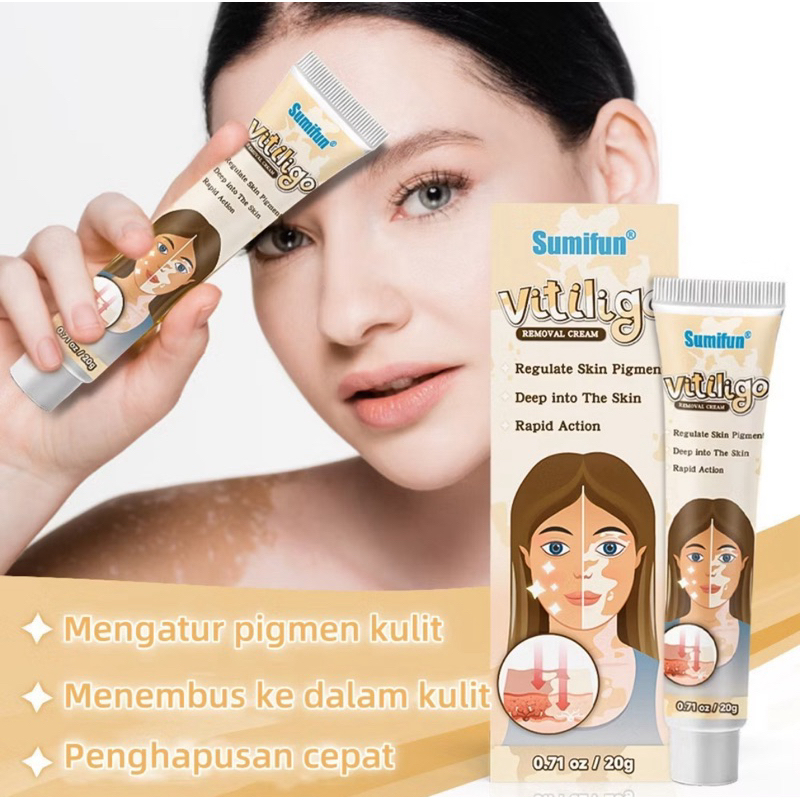 100% SALEP VILITIGO BERCAK PUTIH/KULIT BELANG / PANU