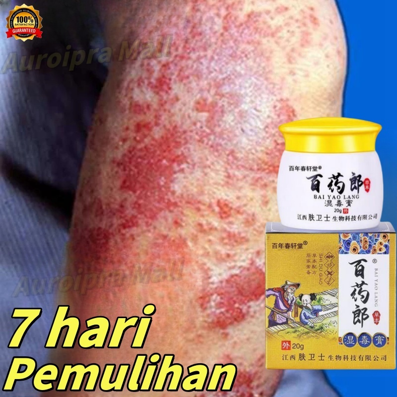 Salep gatal china paling ampuh obat eksim salep panu obat gatal salep gatal selangkangan salep eksim