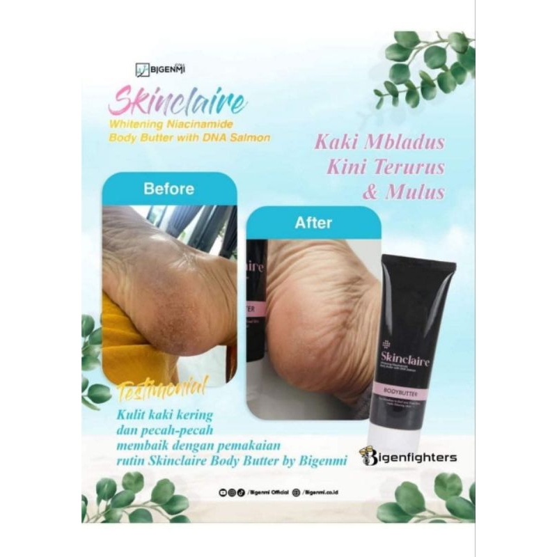Bigenmi lotion Skinclaire