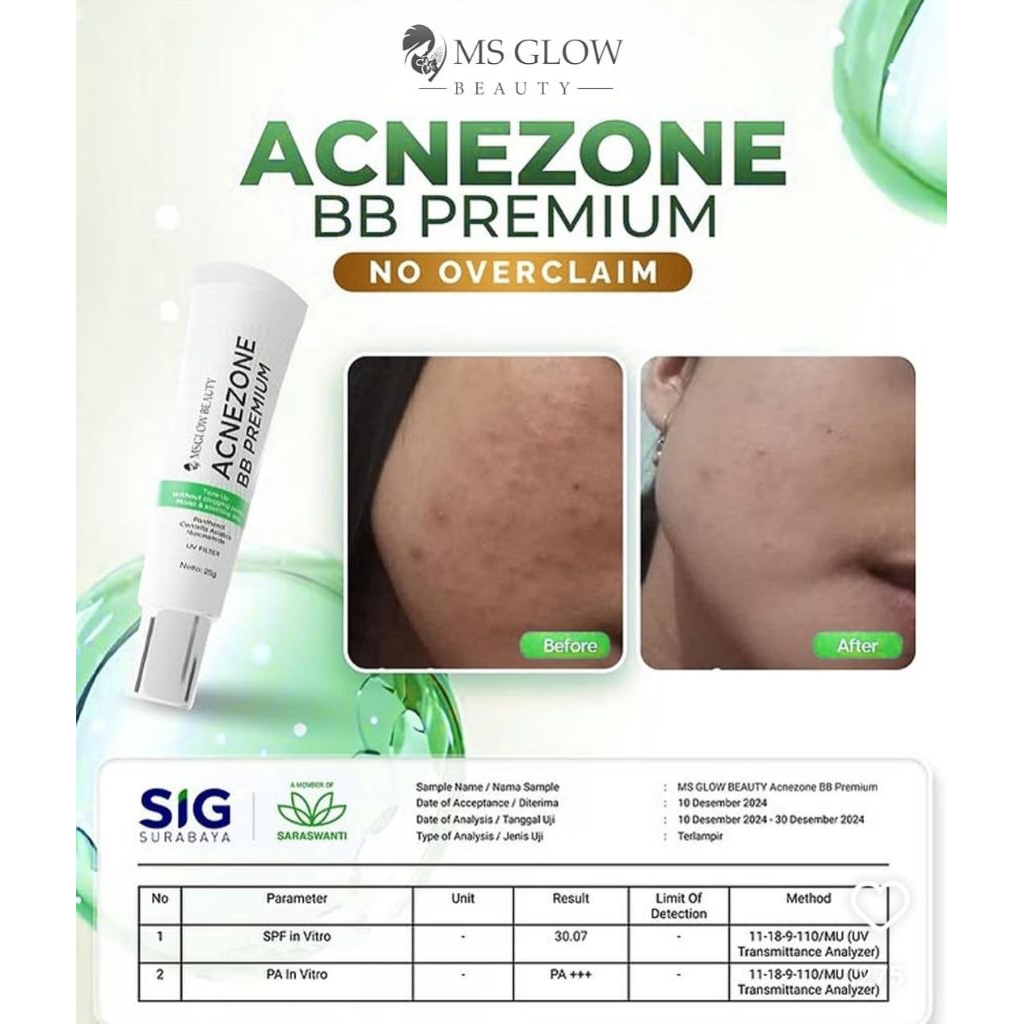 Acne Zone BB Premium MS GLOW