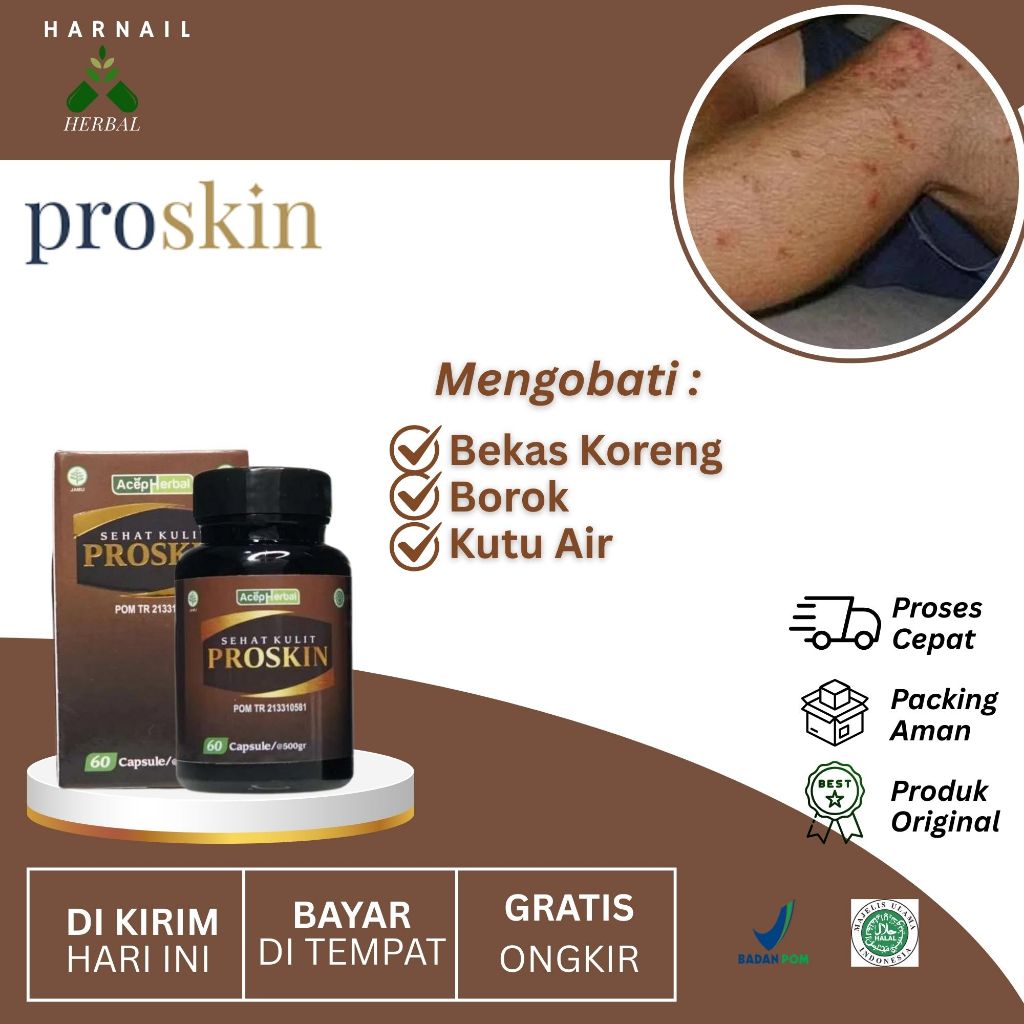 Obat Cenang Bernanah,Penghilang Bekas Koreng, Borok, Kudis Kutu Air Dengan Kapsul Proskin