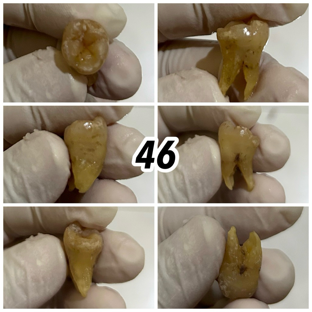 JUAL GIGI ASLI PRAKTIKUM / GIGI MANUSIA / KEDOKTERAN GIGI