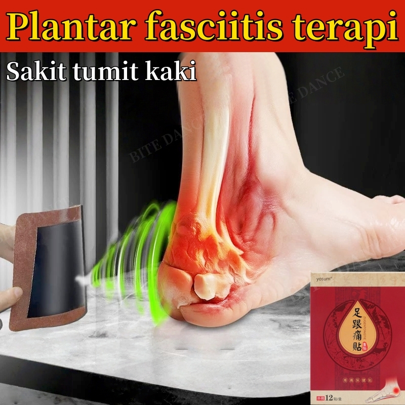 obat sakit tumit Plantar fasciitis terapi Koyo kaki pereda nyeri Pengobatan sakit tumit kaki kaki