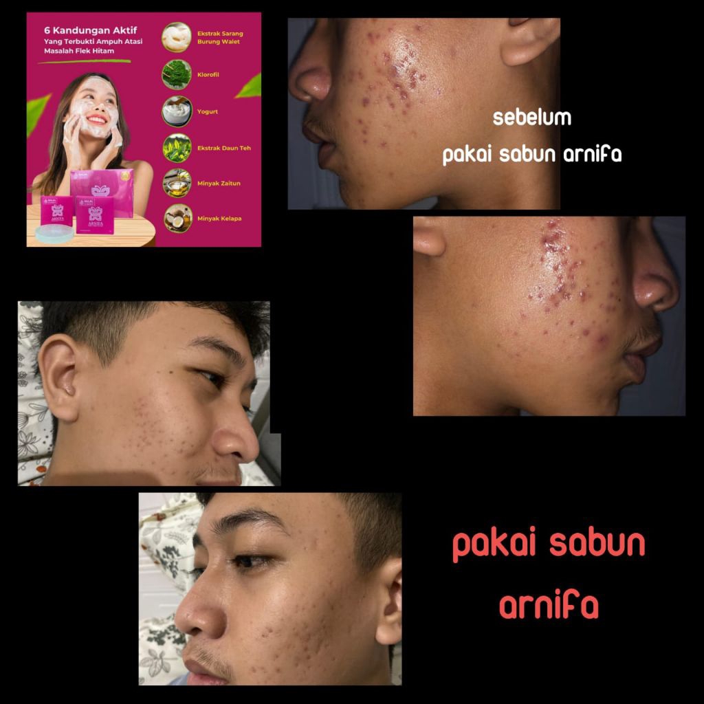 SABUN ARNIFA NYERTEA 1 BIJI