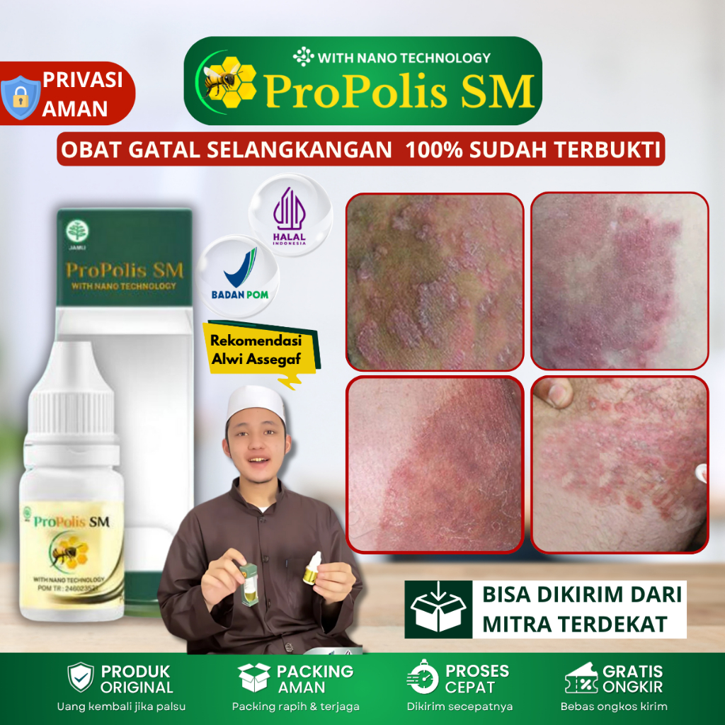 Obat Gatal Selangkangan, Pemutih Selangkangan, Gatal Kelamin, Pemulus Pantat Burik, Salep Gatal Sela