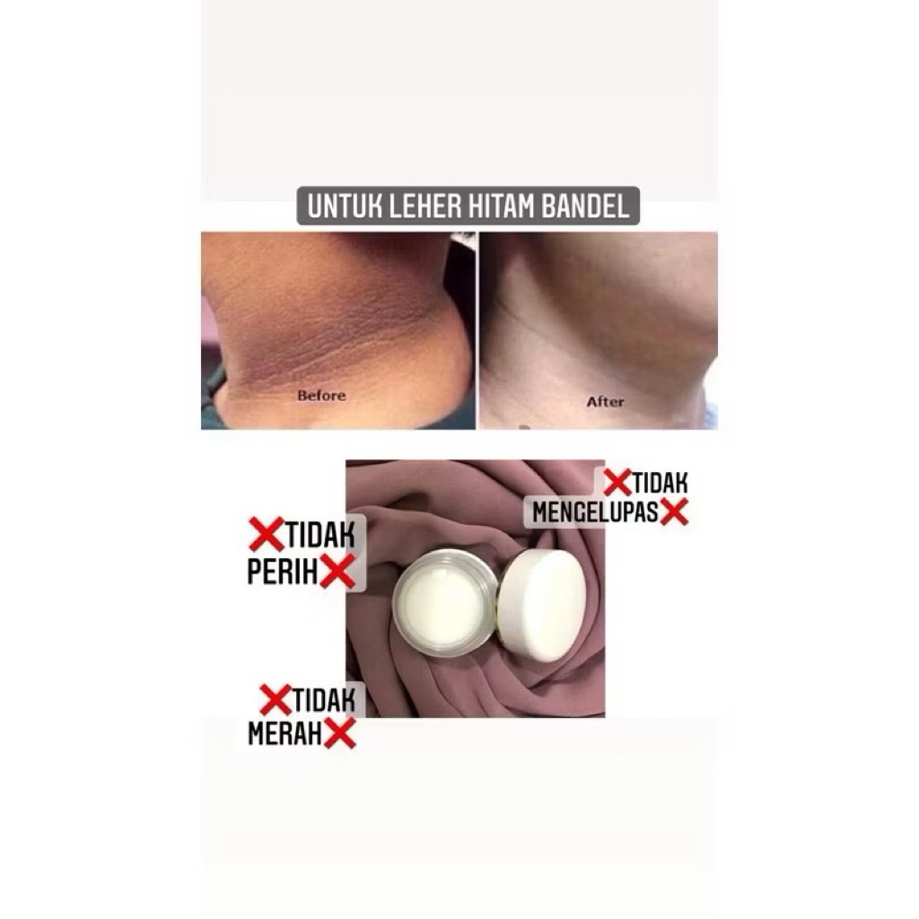 CREAM PEMUTIH LEHER AMPUH ~ ANTI WAJAH PUTIH LEHER HITAM / NECK CREAM [CREAM LEHER]