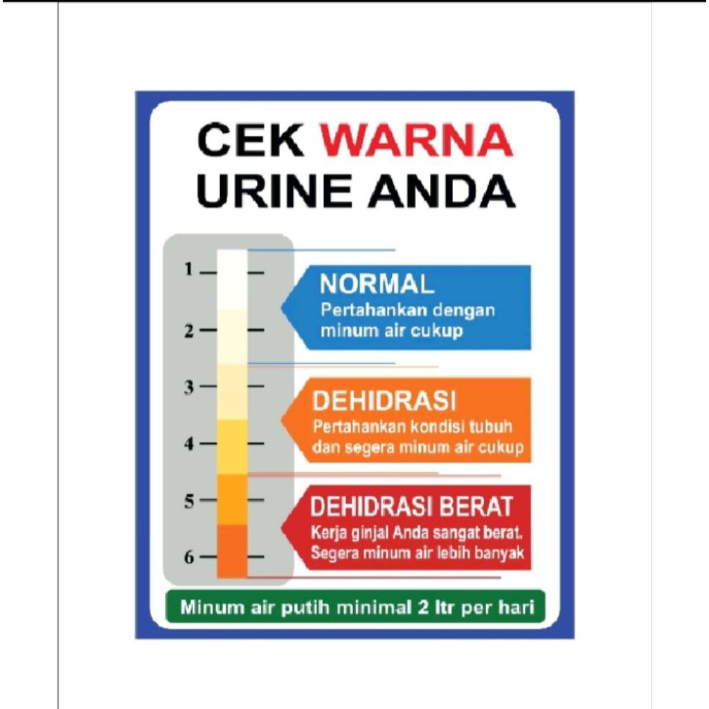 

Stiker vinyl CEK WARNA URINE ANDA sign rambu k3