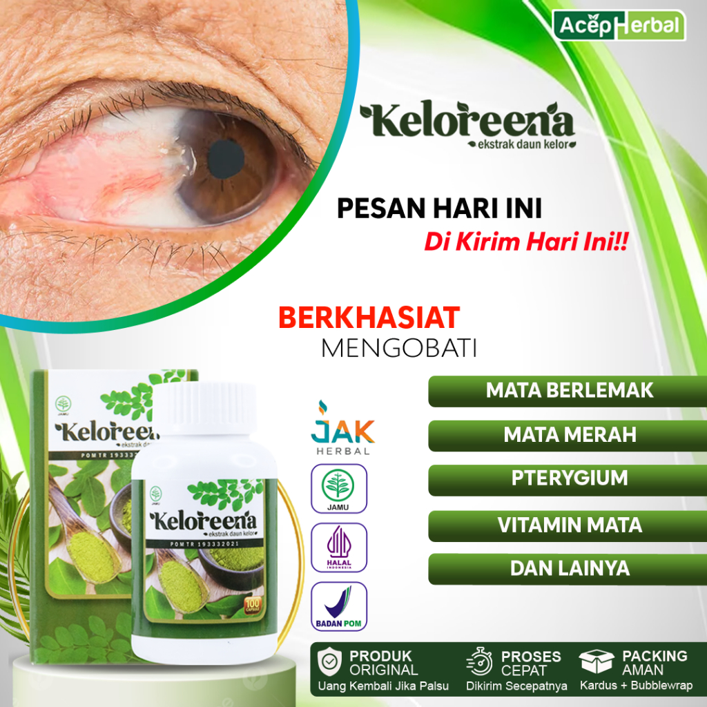 Obat Mata Berlemak Mata piterigium Mata Merah Mata Kuning Mata Floaters Mata Berbayang Kapsul Kelore