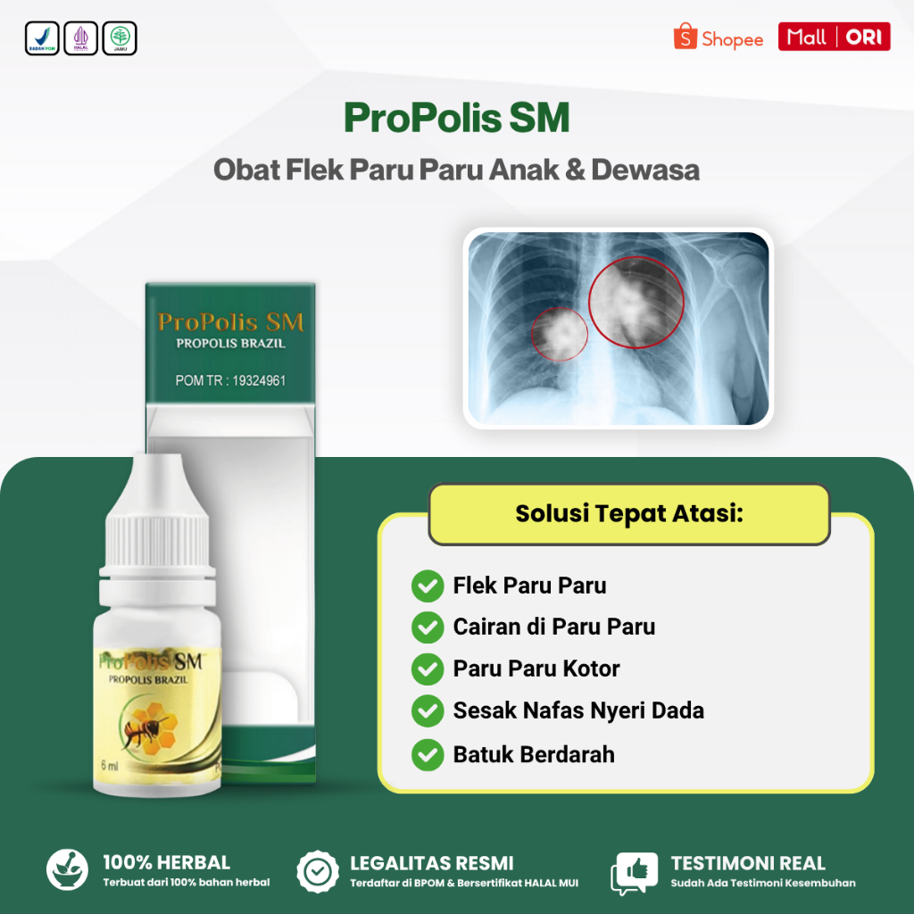 Propolis SM - Obat Flek Paru Paru, Pembersih Paru Paru, Penghilang Cairan di Paru Paru Anak & Dewasa