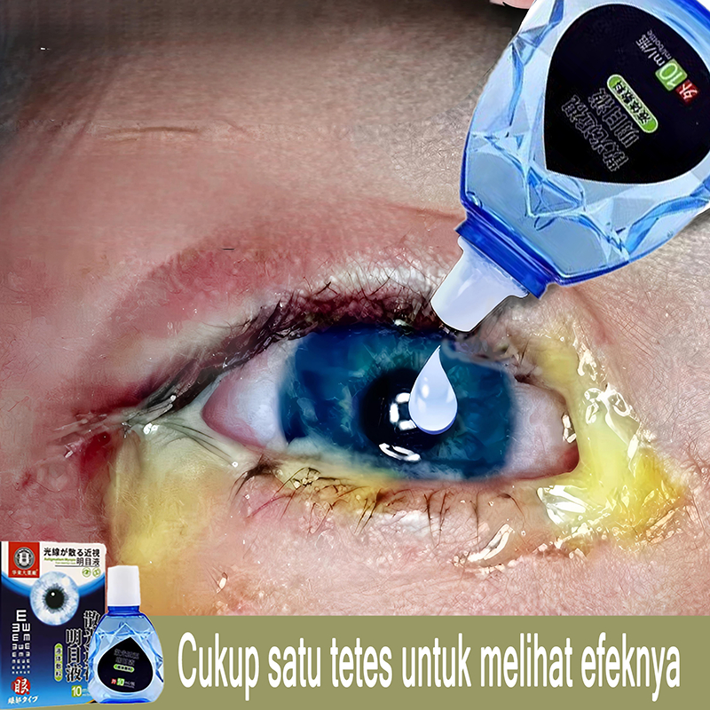 obat tetes mata no 1 di jepang tetes mata katarak mata katarak tanpa operasi obat katarak obat mata 