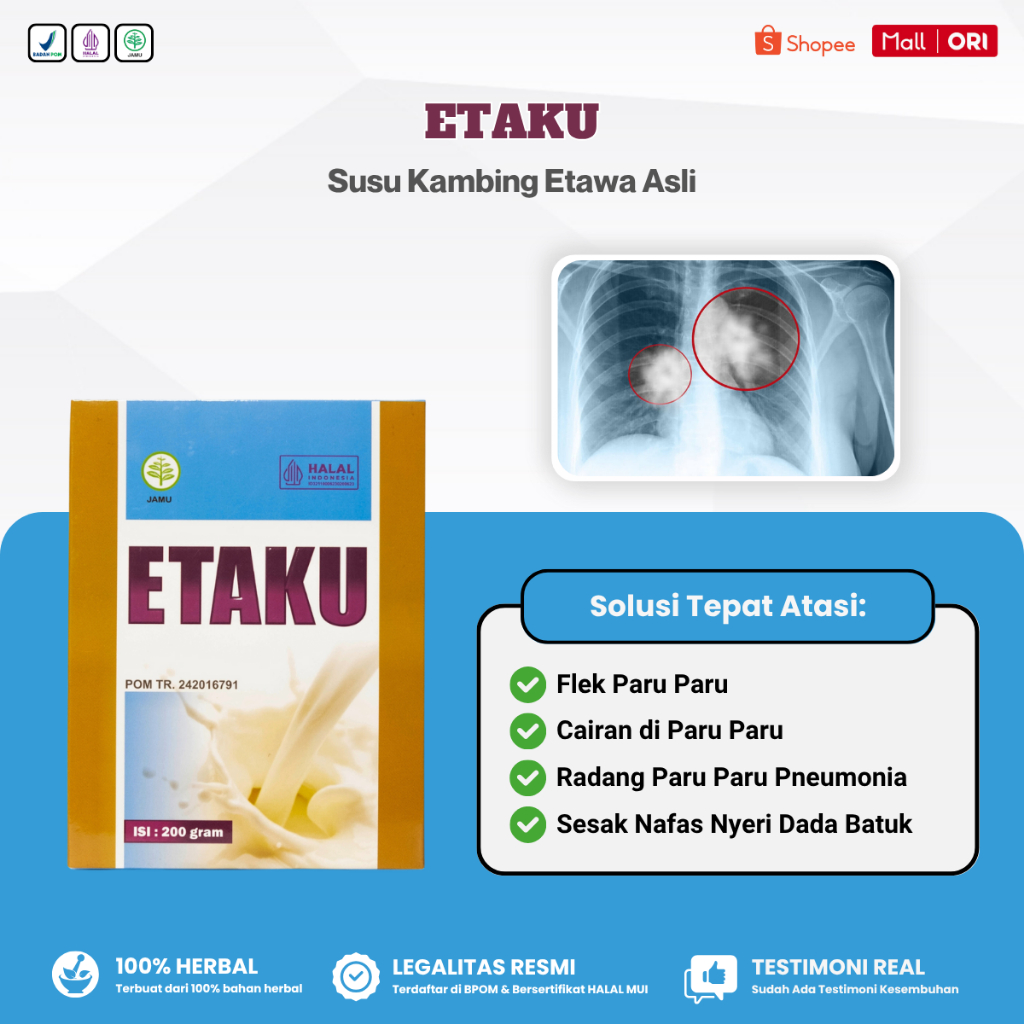 

Obat Flek Paru Paru, Pembersih Paru Paru, Penghilang Cairan di Paru Paru - Etaku Susu Kambing Etawa