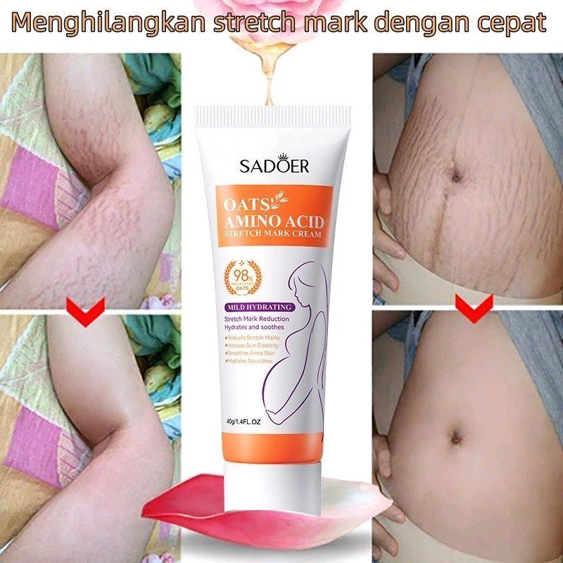 ready cream stremart 0SADOER Oats Amino Acid Stretch Mark Cream Krim Penghilang Stretchmark Permanen