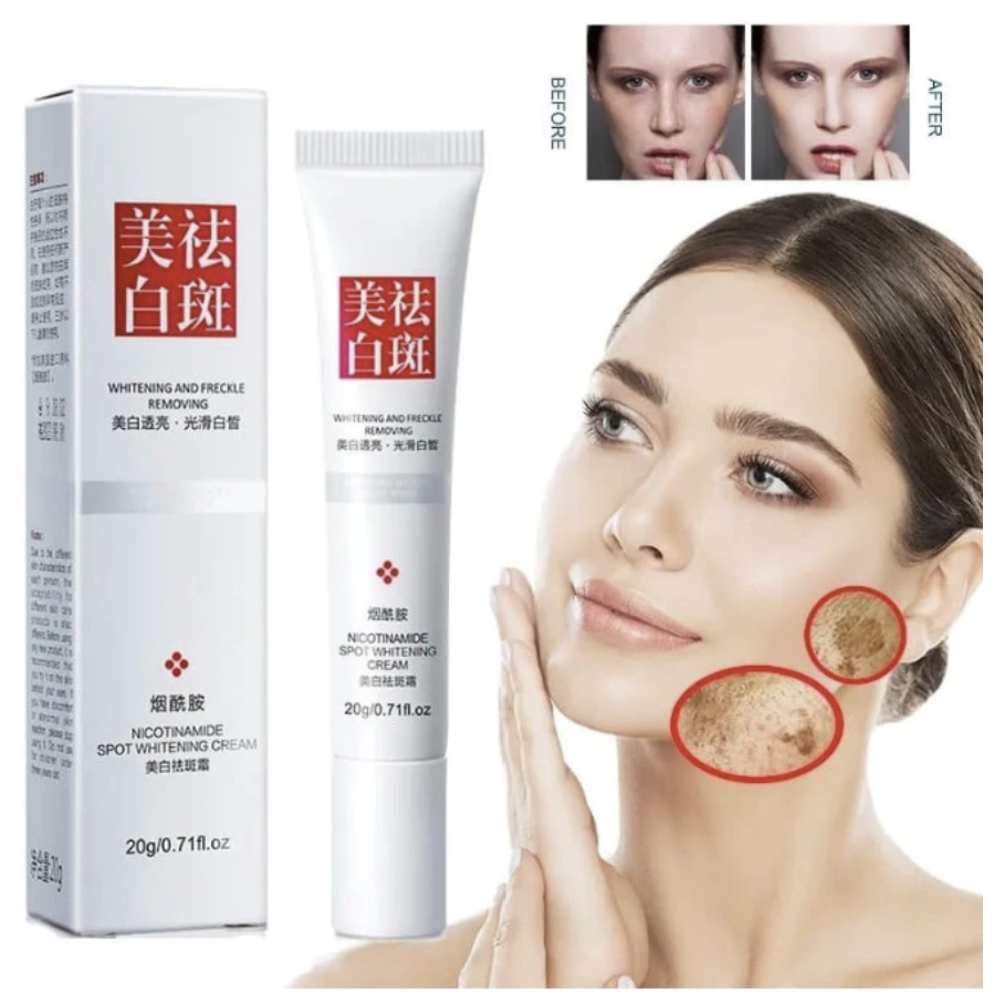 FUYAN SPOT WHITENING CREAM 20gr CREAM PEMUTIH PENGHILANG FLEK HITAM