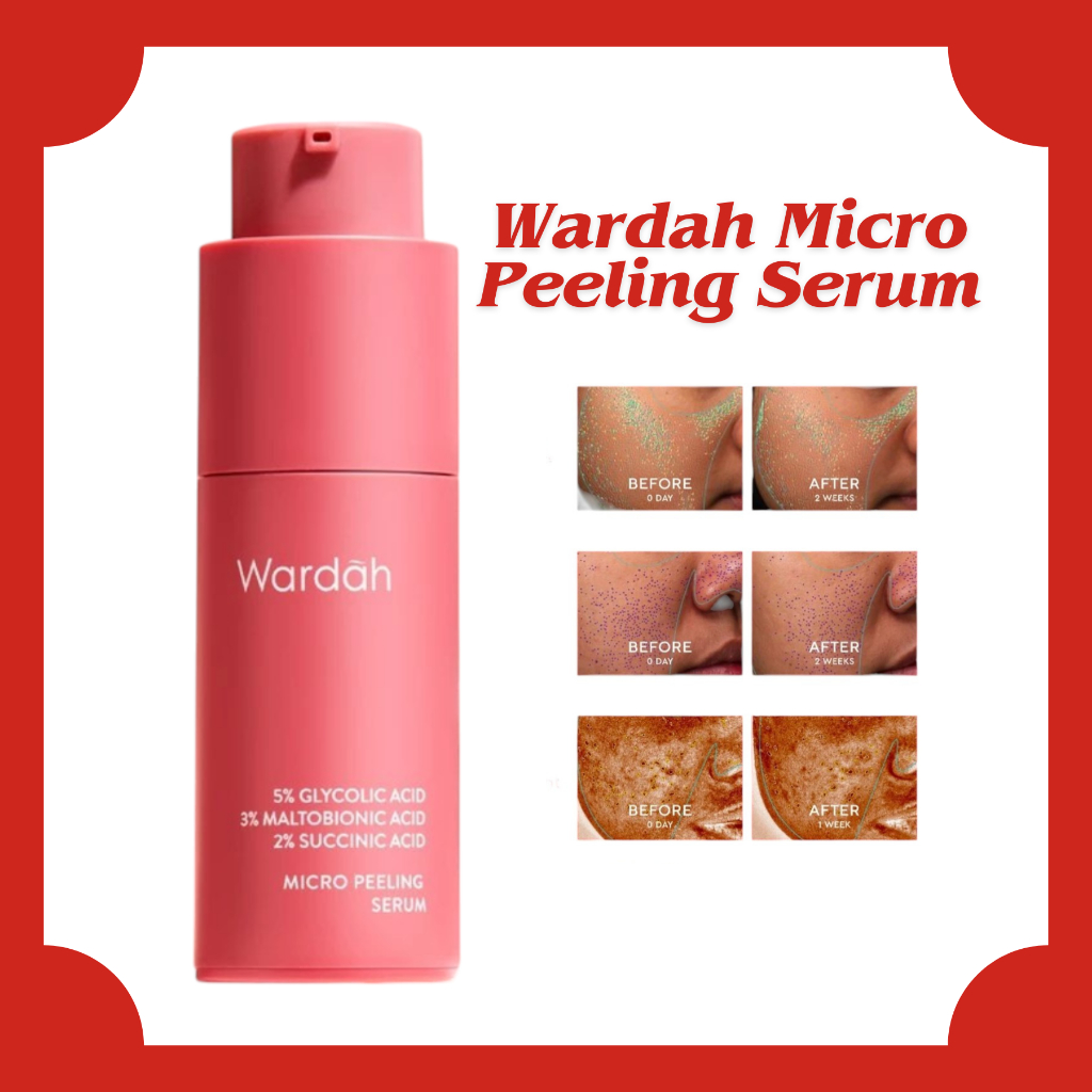 Wardah 5% Glycolic Acid Micro Peeling Serum 20ml/Serum Wajah