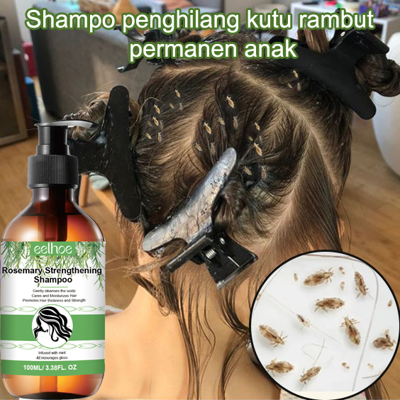 rosemary Shampo Kutu Rambut Anak dan Dewasa shampoo anti ketombe dan rontok 500ml Shampo tanaman ala