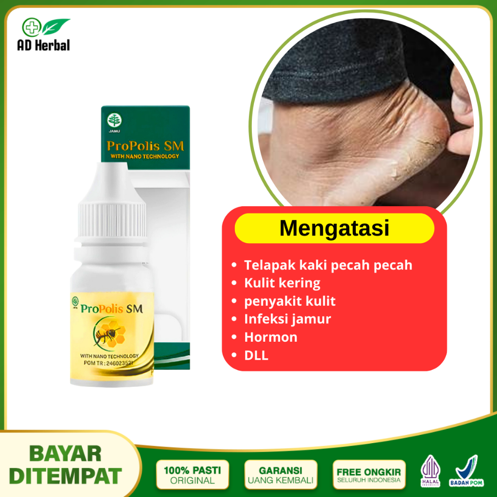 Obat Tetes Kaki Pecah Dan Kering Kaki Pecah Dan Gatal Kaki Rayapan Propolis SM