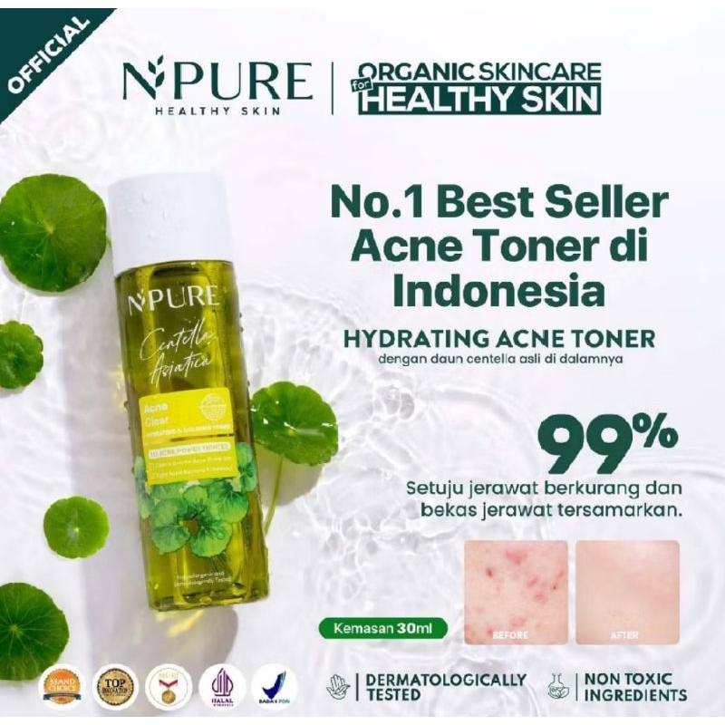 NPURE ACNE TONER || Toner Npure || Toner Acne Npure || Toner Jerawat