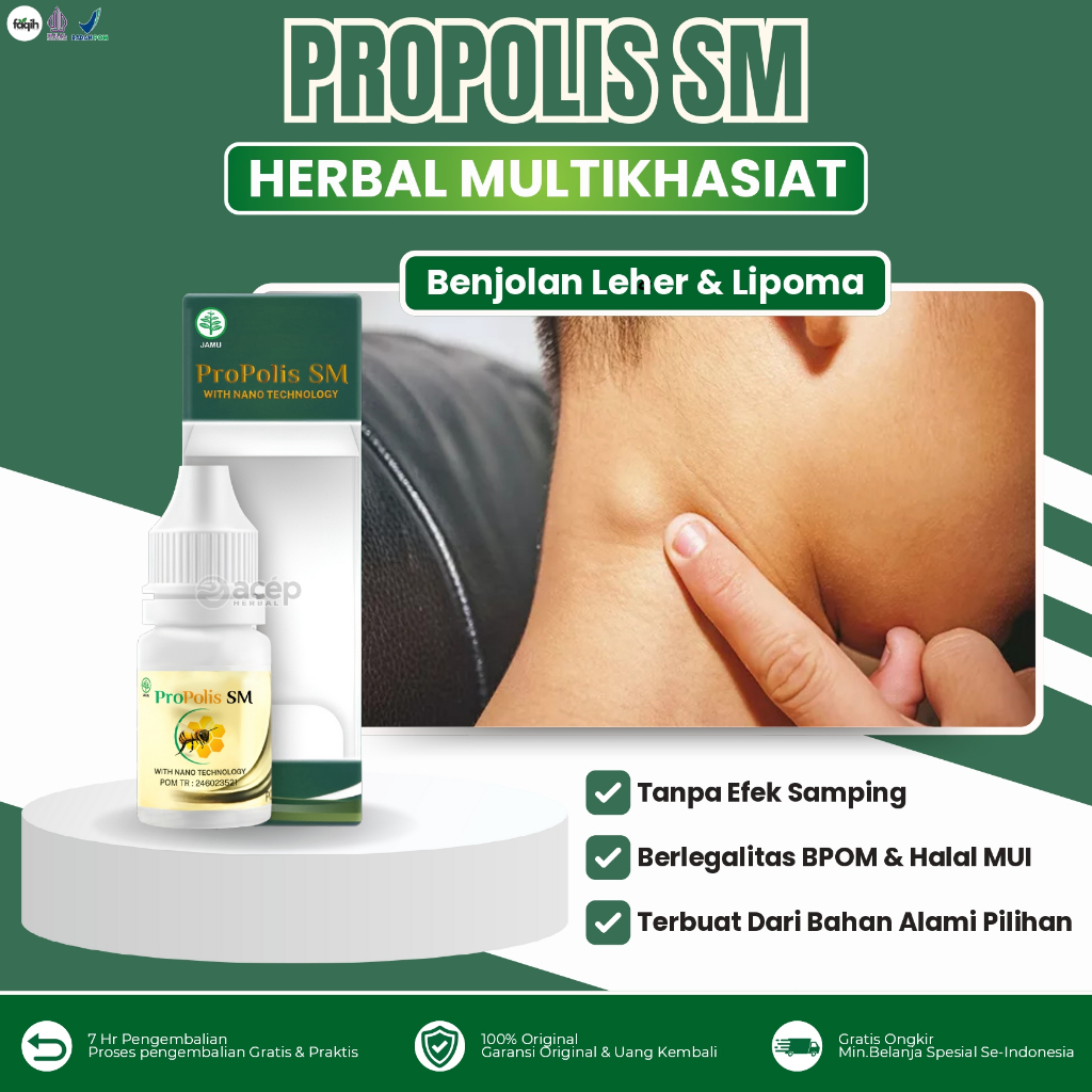 Propolis SM Obati Benjolan Leher Lipoma Benjolan Keloid Benjolan Ketiak Atasi Keloid 100% Original