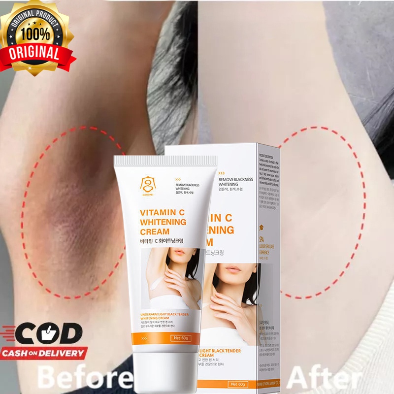 Krim Pemutih Ketiak Pemutih Selangkangan Vagina Pembersih Selangkangan Hitam Krim Pemutih Ketiak Pem