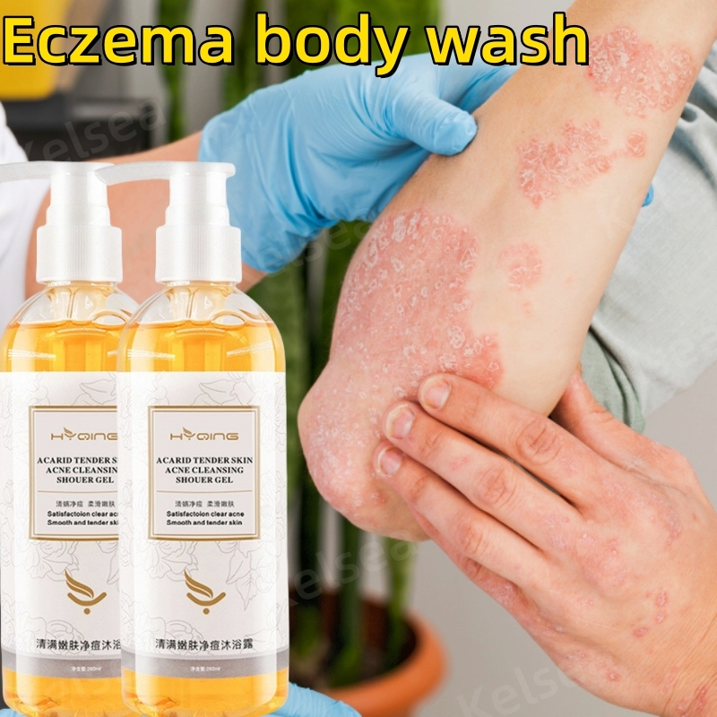 Sabun eksim Sabun gatal kulit yang ampuh Penghilang Eksim kering Psoriasis Panu Sabun Anti bakteri