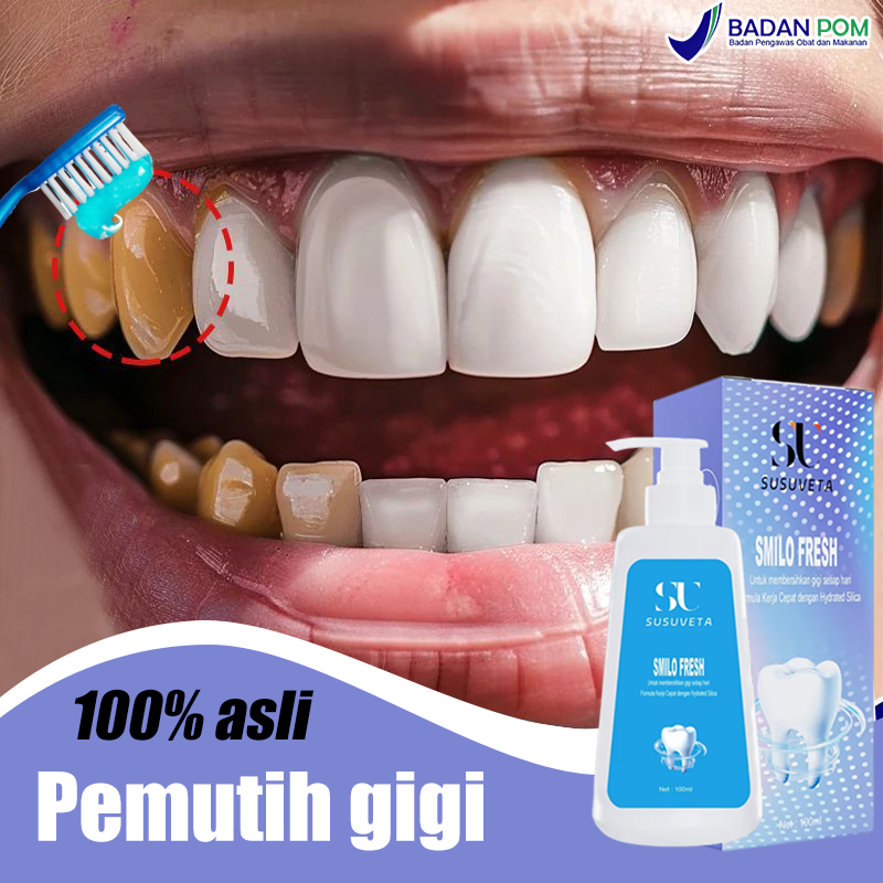 Pemutih gigi Pembersih karang gigi Odol pemutih gigi dan karang gigi Perontok karang gigi paling amp