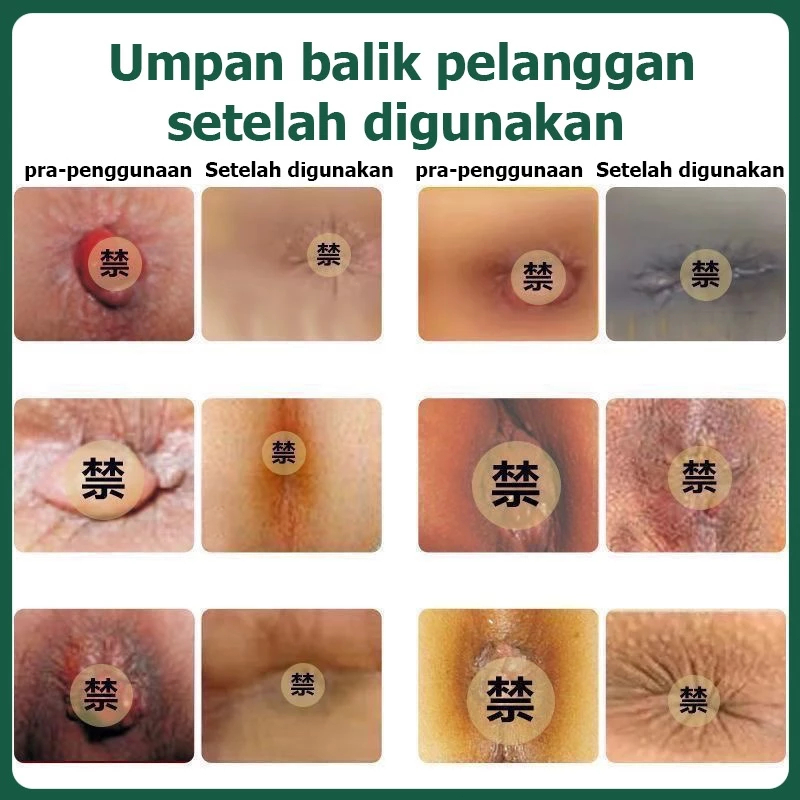 ISA Salep ambeien paling ampuh Salep wasir paling ampuh Obat wasir Obat ambeien 30ml Obat ambeien