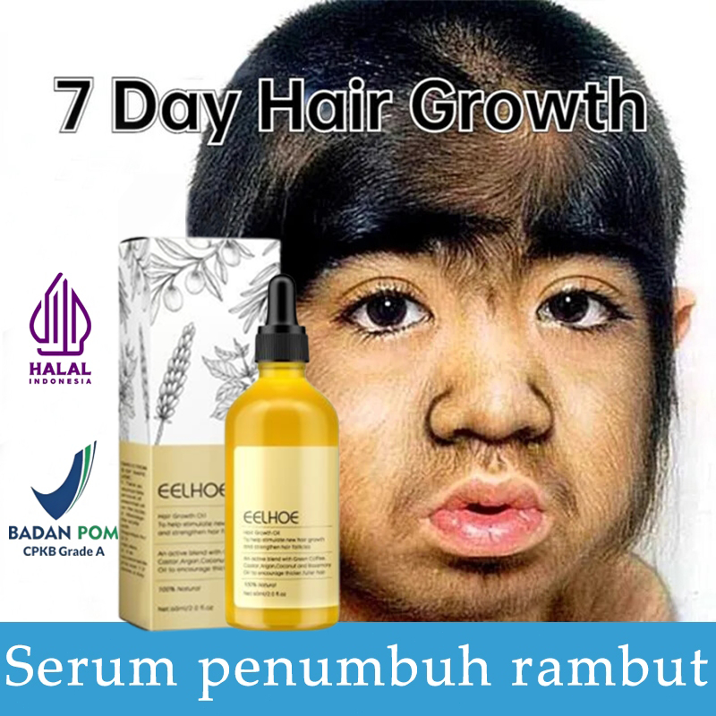 rosmery oil untuk rambut penumbuh rambut serum penumbuh rambut hair serum rambut rontok Hair Growth 