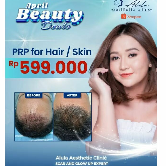 Voucher Treatment PRP Skin / Hair