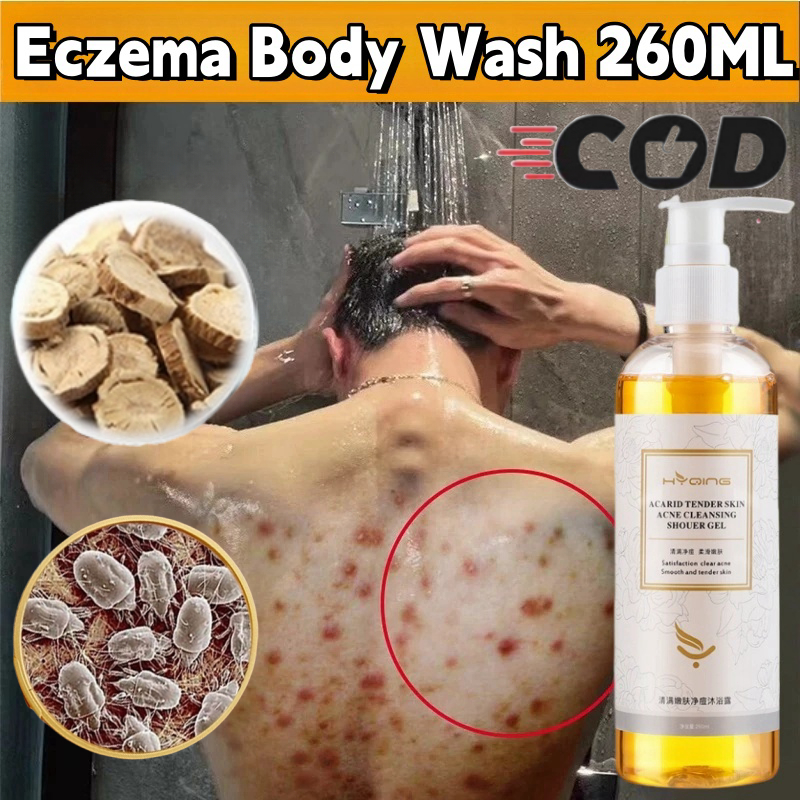 【COD ORI】Eczema Body Wash 260ML Body Wash Acne Whitening Pengobatan Eksim Psoriasis Eksim Kering Kur