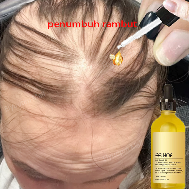 Rosmery oil untuk rambut penumbuh rambut Penumbuh rambut botak Penumbuh rambut cepat dan tebal Anti 