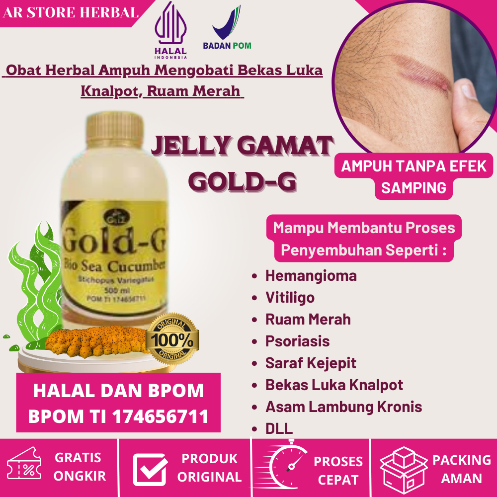 (Gold G) Obat Penghilang Bekas Luka Knalpot, Luka Bakar Paling AMPUH