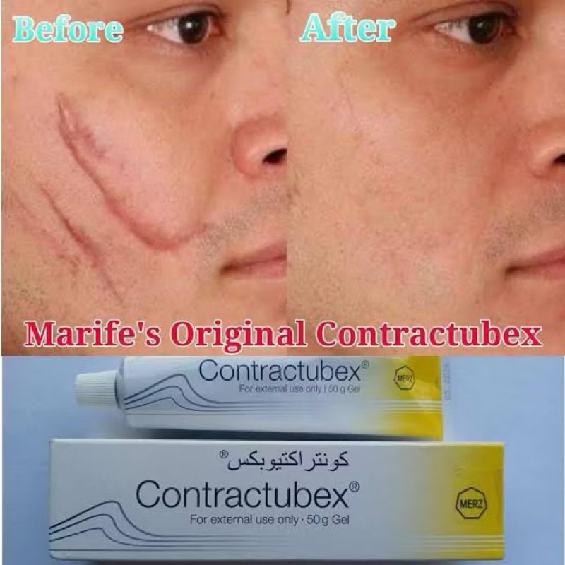 contractubex scar gel