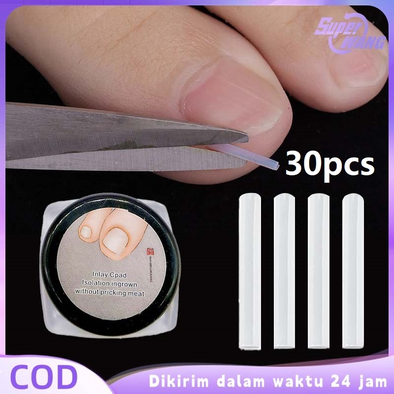 30pcs Bantalan Kuku Silikon Ingrown Nail Correction Silikon Kuku Cantengan Bantalan Kuku Cantengan