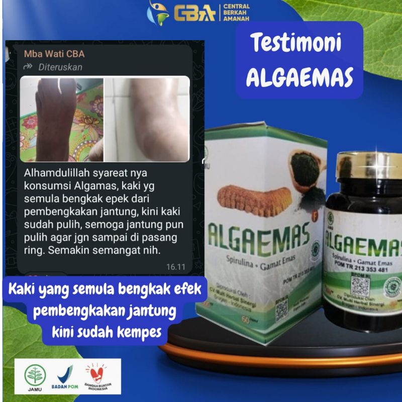

algaemas