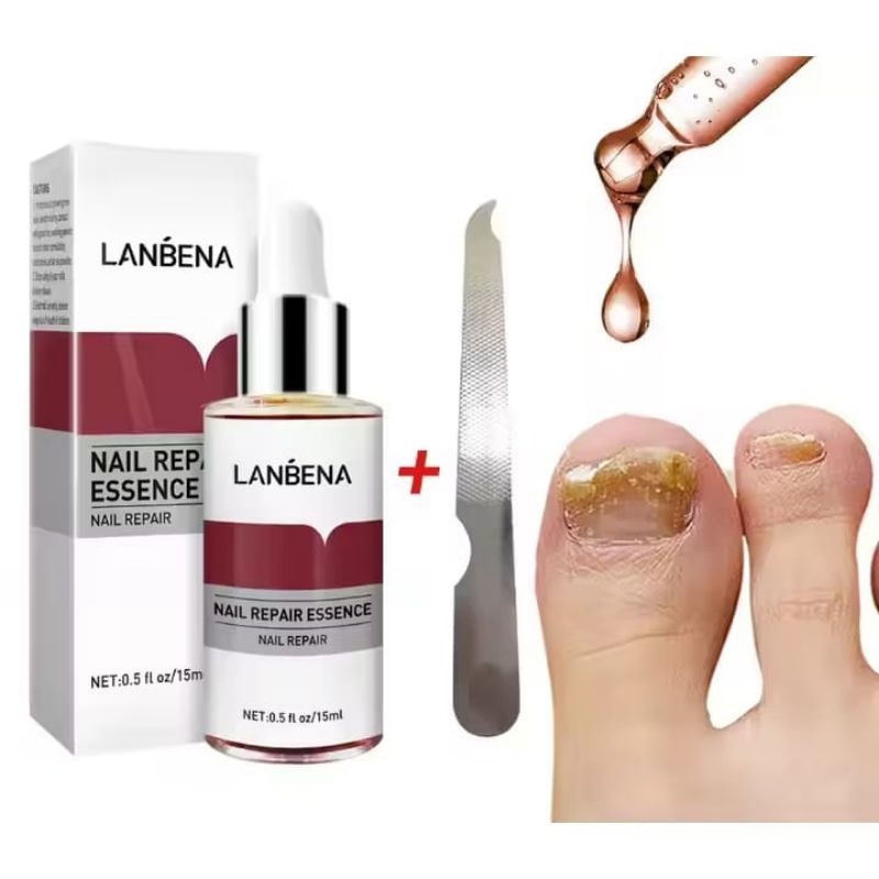 LANBENA NAILREPAIR ESSENCE Obat Kuku Serum Jamur Kuku Perbaikan Kuku Rusak