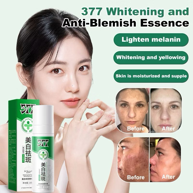 377 whitening and anti blemish essence