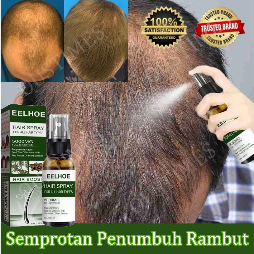 Semprotan Penumbuh Rambut Obat Rambut Botak Hair Growth Serum Hair Tonic Penumbuh rambut botak Peneb