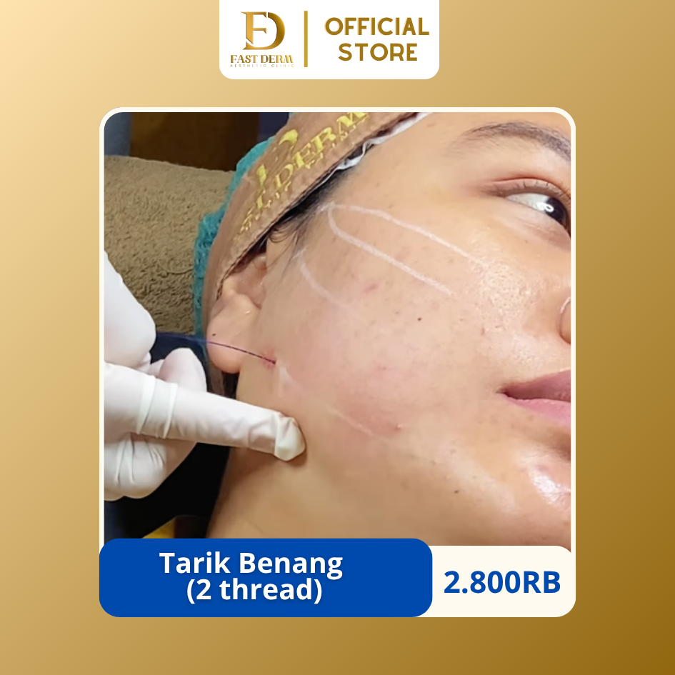 Fast Derm Aesthetic Clinic | TARIK BENANG (Lifting With Vxil (2 thread)